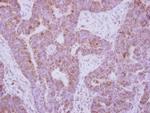 IL10RA Antibody in Immunohistochemistry (Paraffin) (IHC (P))