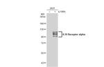 IL10RA Antibody in Western Blot (WB)