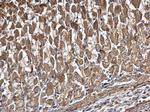 DDX6 Antibody in Immunohistochemistry (Paraffin) (IHC (P))