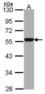 DDX6 Antibody in Western Blot (WB)