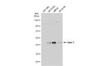 ISL1 Antibody in Western Blot (WB)