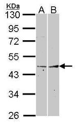 Fibromodulin Antibody in Western Blot (WB)