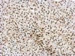 AF9 Antibody in Immunohistochemistry (Paraffin) (IHC (P))