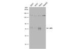 AF9 Antibody in Western Blot (WB)