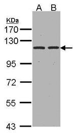 CD249 Antibody in Western Blot (WB)