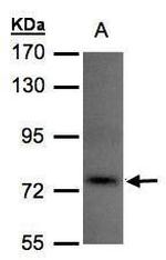 TLK1 Antibody in Western Blot (WB)