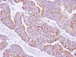 JIK Antibody in Immunohistochemistry (Paraffin) (IHC (P))