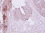 MCC Antibody in Immunohistochemistry (Paraffin) (IHC (P))