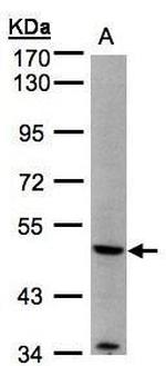 MMP12 Antibody in Western Blot (WB)