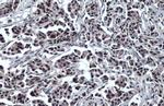 p53 Antibody in Immunohistochemistry (Paraffin) (IHC (P))