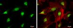 CDK4 Antibody in Immunocytochemistry (ICC/IF)