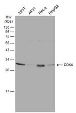 CDK4 Antibody in Western Blot (WB)