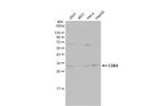 CDK4 Antibody in Western Blot (WB)