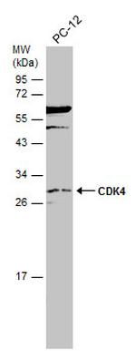 CDK4 Antibody in Western Blot (WB)