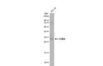 CDK4 Antibody in Western Blot (WB)