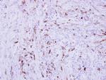 Collagen III Antibody in Immunohistochemistry (Paraffin) (IHC (P))