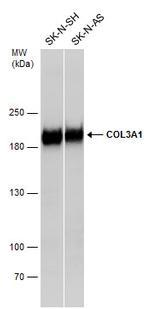 Collagen III Antibody in Western Blot (WB)