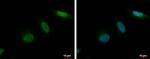 MCAK Antibody in Immunocytochemistry (ICC/IF)