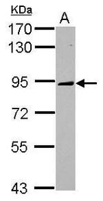 MCAK Antibody in Western Blot (WB)