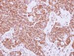 Cyclin A2 Antibody in Immunohistochemistry (Paraffin) (IHC (P))