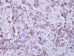 IFNGR1 Antibody in Immunohistochemistry (Paraffin) (IHC (P))