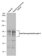 IFNGR1 Antibody in Western Blot (WB)