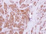 OCRL Antibody in Immunohistochemistry (Paraffin) (IHC (P))