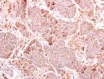 MDA5 Antibody in Immunohistochemistry (Paraffin) (IHC (P))