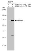 MDA5 Antibody in Western Blot (WB)