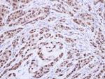 XPA Antibody in Immunohistochemistry (Paraffin) (IHC (P))