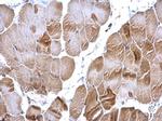 RRM2 Antibody in Immunohistochemistry (Paraffin) (IHC (P))