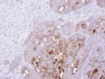 SERPINB2 Antibody in Immunohistochemistry (Paraffin) (IHC (P))