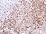 GRP94 Antibody in Immunohistochemistry (Paraffin) (IHC (P))