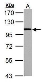 alpha Actinin 3 Antibody in Western Blot (WB)