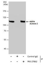 alpha Actinin 3 Antibody in Immunoprecipitation (IP)
