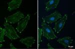 alpha Actinin 2 Antibody in Immunocytochemistry (ICC/IF)