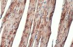 alpha Actinin 2 Antibody in Immunohistochemistry (Paraffin) (IHC (P))