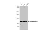 alpha Actinin 2 Antibody in Western Blot (WB)