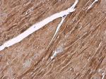 alpha Actinin 2 Antibody in Immunohistochemistry (Paraffin) (IHC (P))