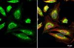 TFAM Antibody in Immunocytochemistry (ICC/IF)