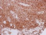 GRP94 Antibody in Immunohistochemistry (Paraffin) (IHC (P))