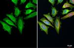 Thymidylate Synthase Antibody in Immunocytochemistry (ICC/IF)