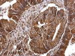 Thymidylate Synthase Antibody in Immunohistochemistry (Paraffin) (IHC (P))