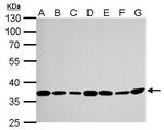 Thymidylate Synthase Antibody in Western Blot (WB)