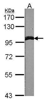 alpha Actinin 1 Antibody in Western Blot (WB)