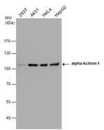 alpha Actinin 1 Antibody in Western Blot (WB)