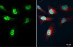 KLF5 Antibody in Immunocytochemistry (ICC/IF)