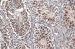 KLF5 Antibody in Immunohistochemistry (Paraffin) (IHC (P))