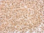 KLF5 Antibody in Immunohistochemistry (Paraffin) (IHC (P))