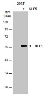 KLF5 Antibody in Western Blot (WB)